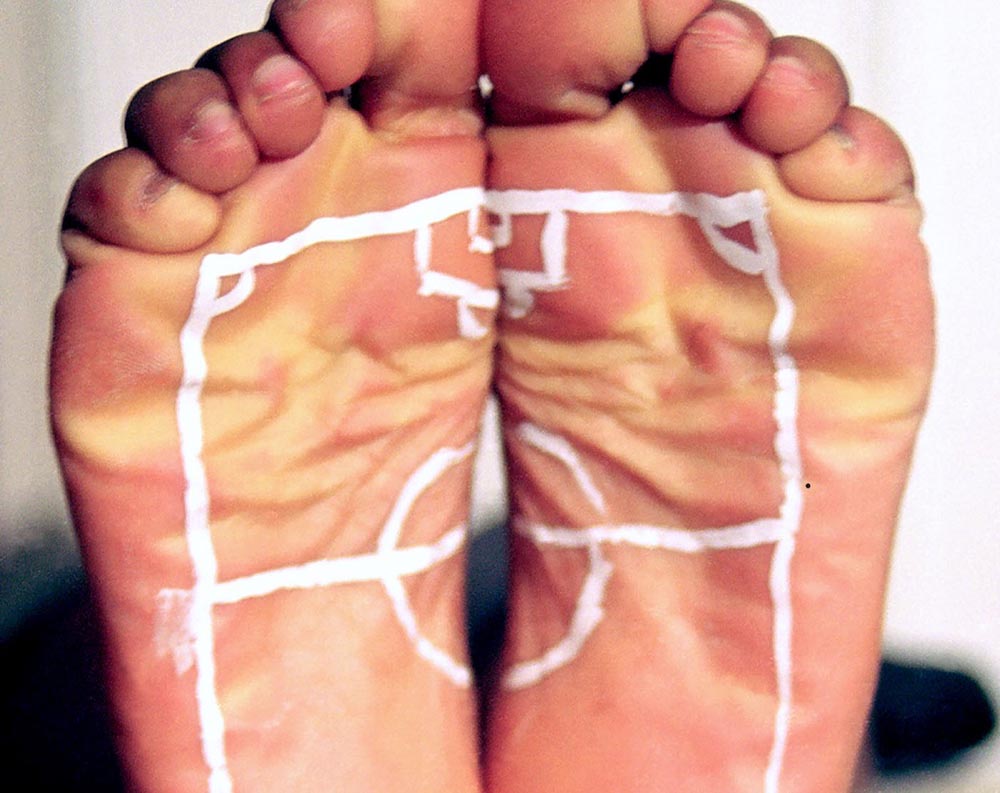 SKIN IN THE GAME — Group show at KW Institute for Contemporary Art, Berlin